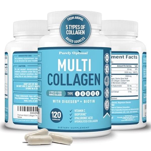 Premium Multi Collagen Peptides (Types I, II, II, V, X) - Collagen Pills for Skin Care, Hair Growth, Nails & Joints - Vitamin C, Hyaluronic Acid, Biotin, Gluten Free - 120 Collagen