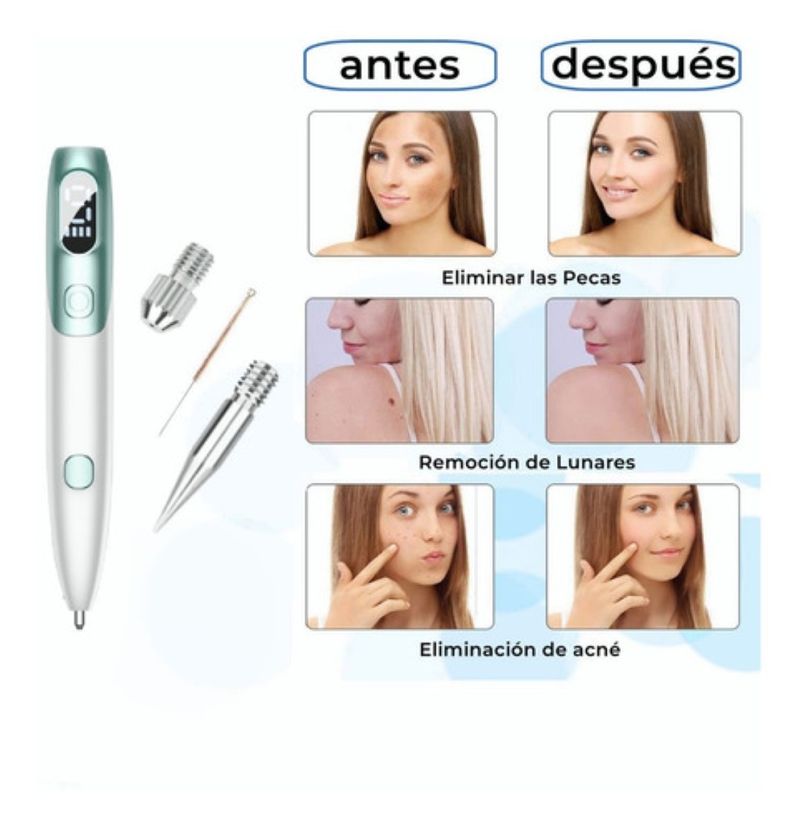 "Pluma Cauterizador De Quita Verrugas Pecas Lunares Verde Blanco "