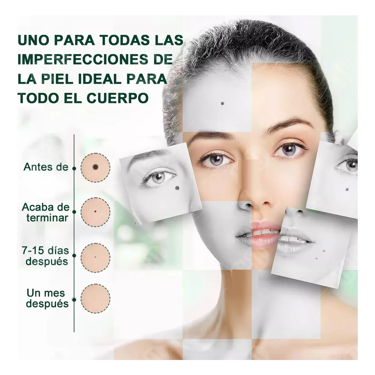 Pluma Quita Verrugas Removedor De Verrugas Manchas Verde