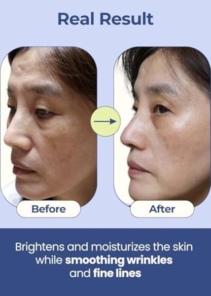 Parches antiarrugas nocturnos PETITE PLUIE para el rostro - Cinta facial coreana premium con colágeno y péptidos - Cinta antiarrugas para líneas de expresión, frente, ojos y patas 